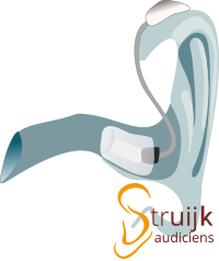 Oplaadbaar gehoorapparaat